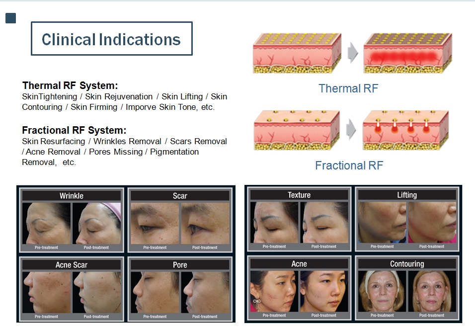 indicaciones clínicas