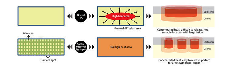 Skin Rejuvenation Machine Máquina de rejuvenecimiento de la piel