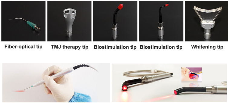 m&aacute;quina l&aacute;ser dental