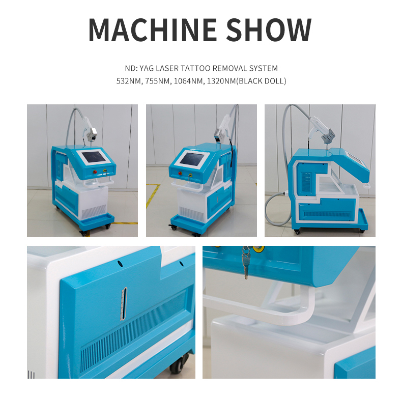 m&aacute;quina de extracci&oacute;n de tatuajes