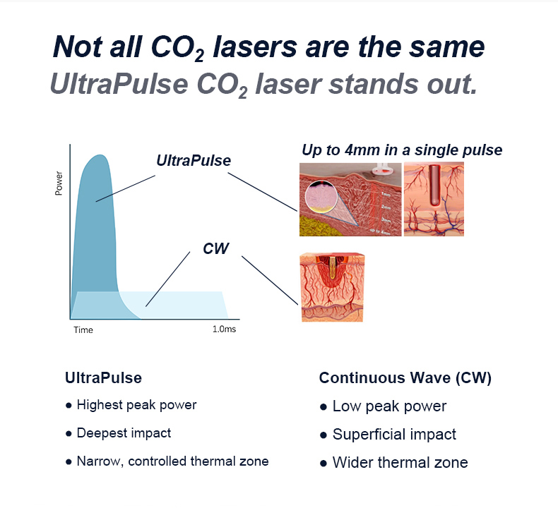 Resurgimiento de la piel