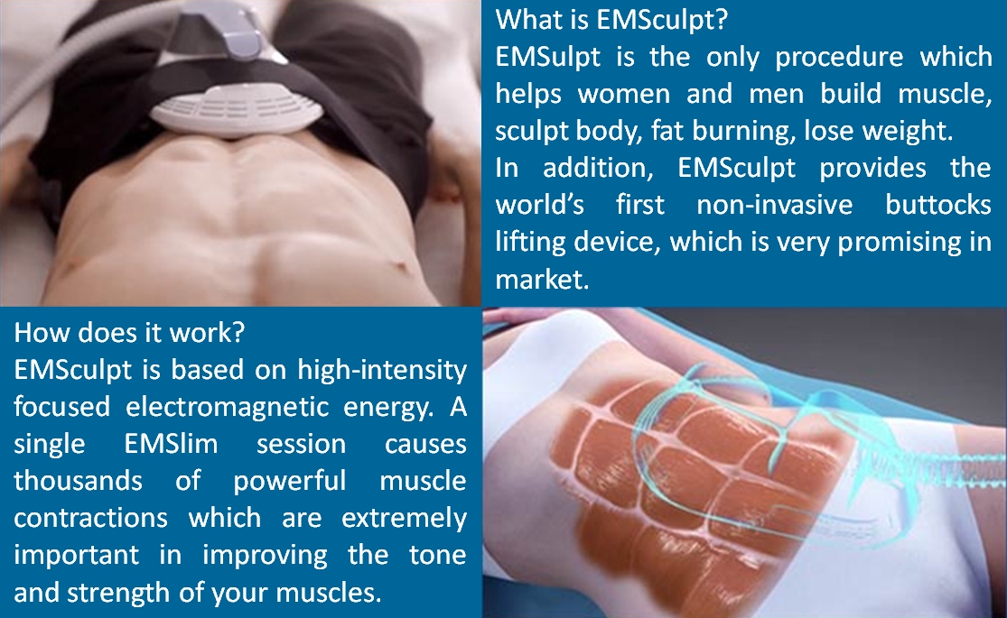 &iquest;Qu&eacute; es EMSculpt?