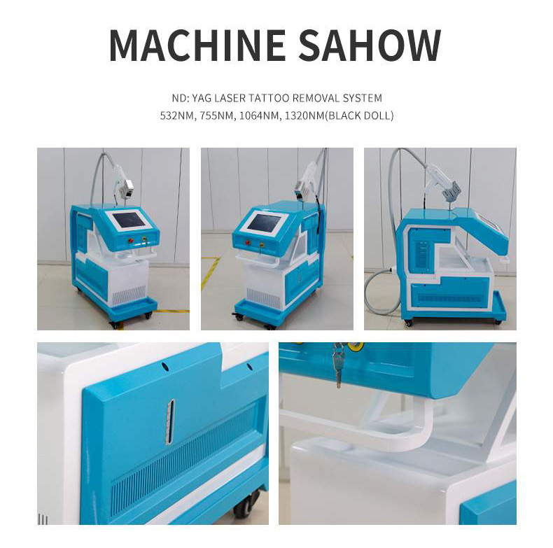 m&aacute;quina de eliminaci&oacute;n de tatuajes