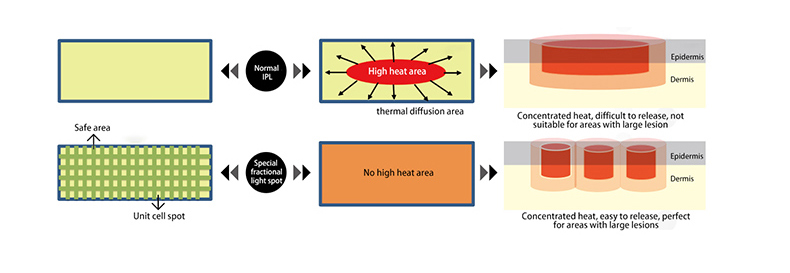 M&aacute;quina profesional de rejuvenecimiento de la piel