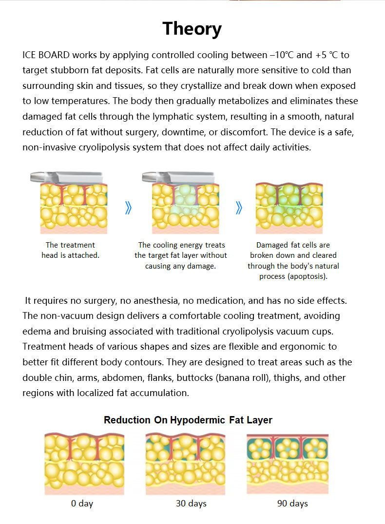 M&aacute;quina de adelgazamiento de tablero congelado 