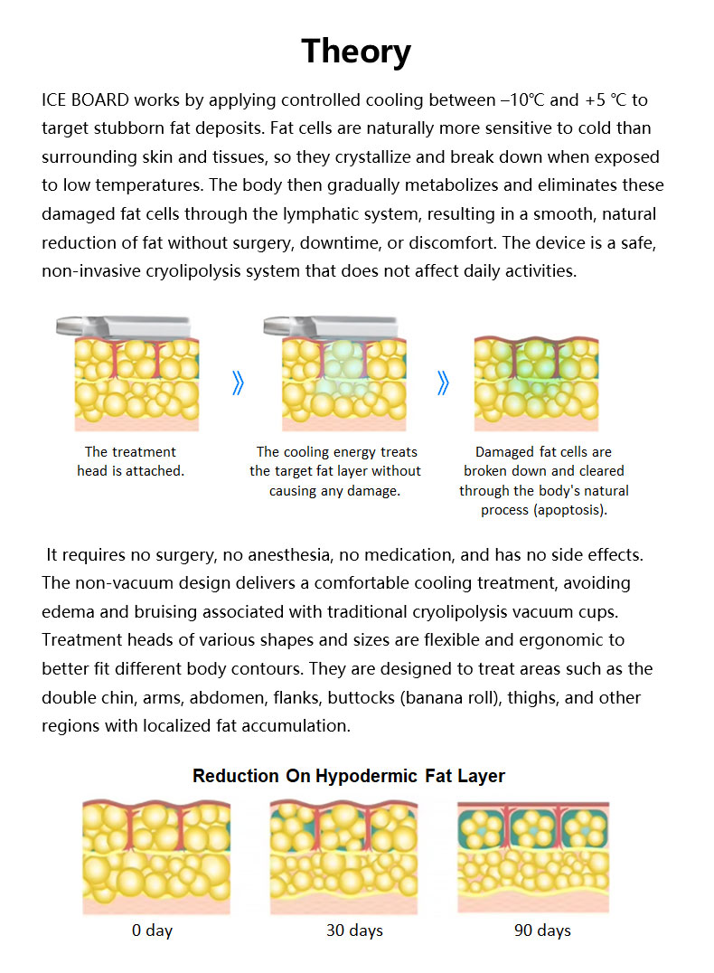 M&aacute;quina de escultura de hielo 
