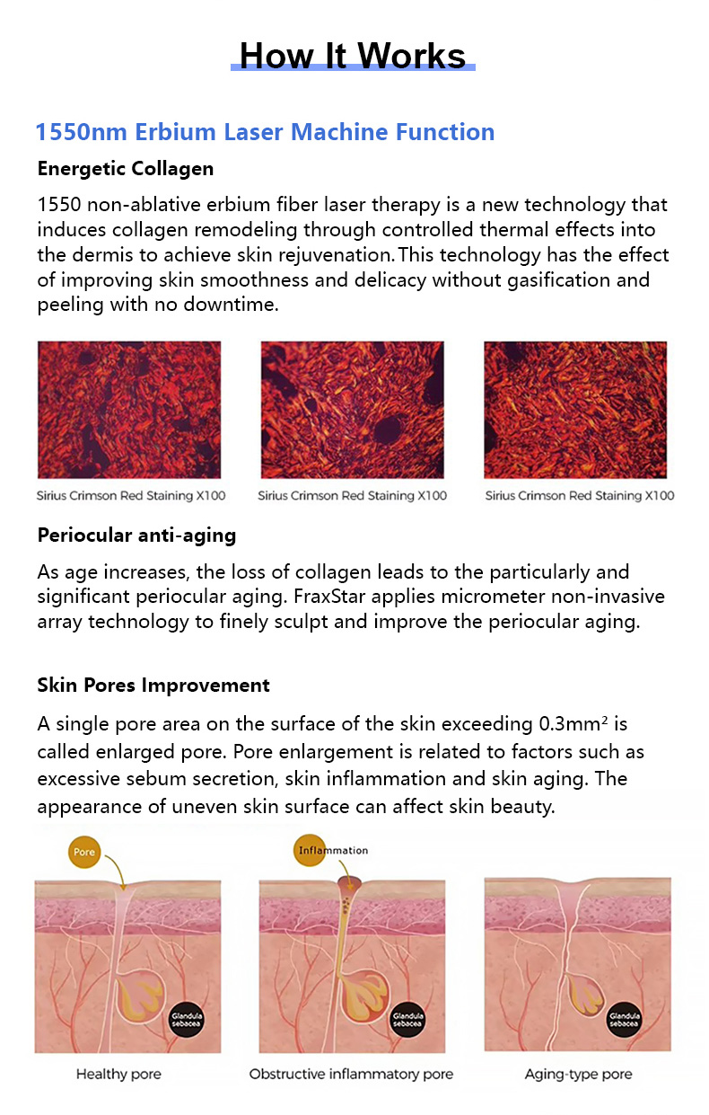 L&aacute;ser de vidrio erbio