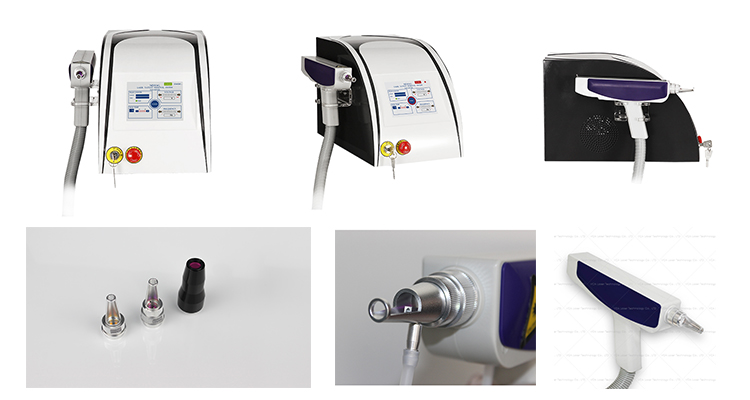 eliminaci&oacute;n de tatuajes con l&aacute;ser yag