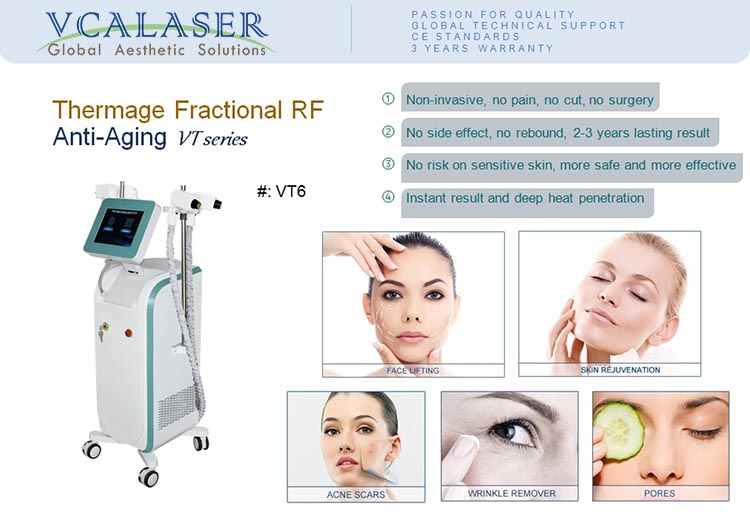 thermage-vcalaser