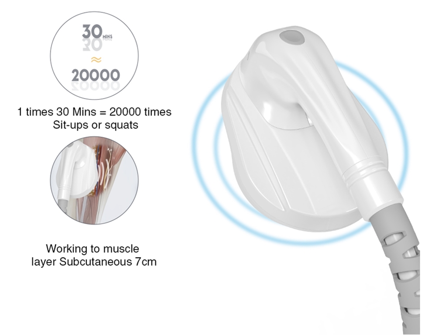 caracter&iacute;stica del ccsme