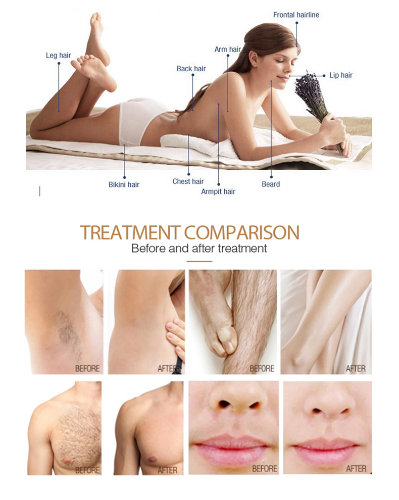 m&aacute;quina de depilaci&oacute;n