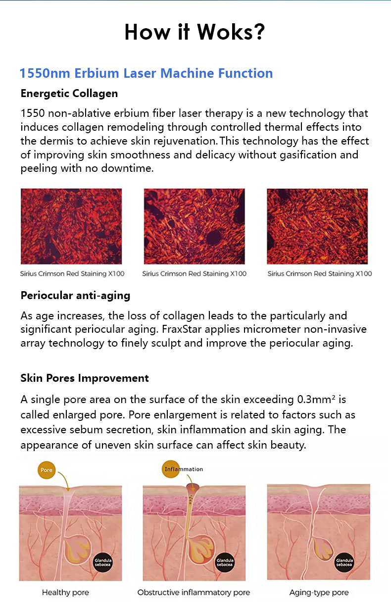 Tonificaci&oacute;n de la piel