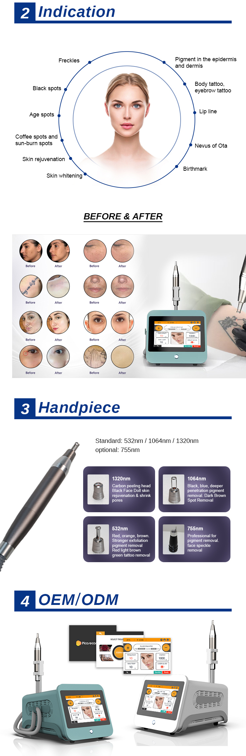 m&aacute;quina de extracci&oacute;n de tatuajes