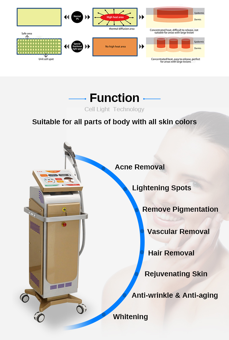 M&aacute;quina de eliminaci&oacute;n de arrugas