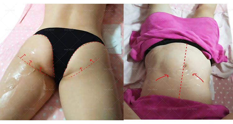 M&aacute;quina de eliminaci&oacute;n de arrugas