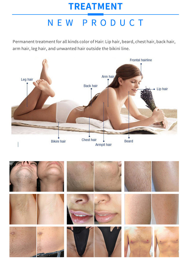 l&aacute;ser de diodo