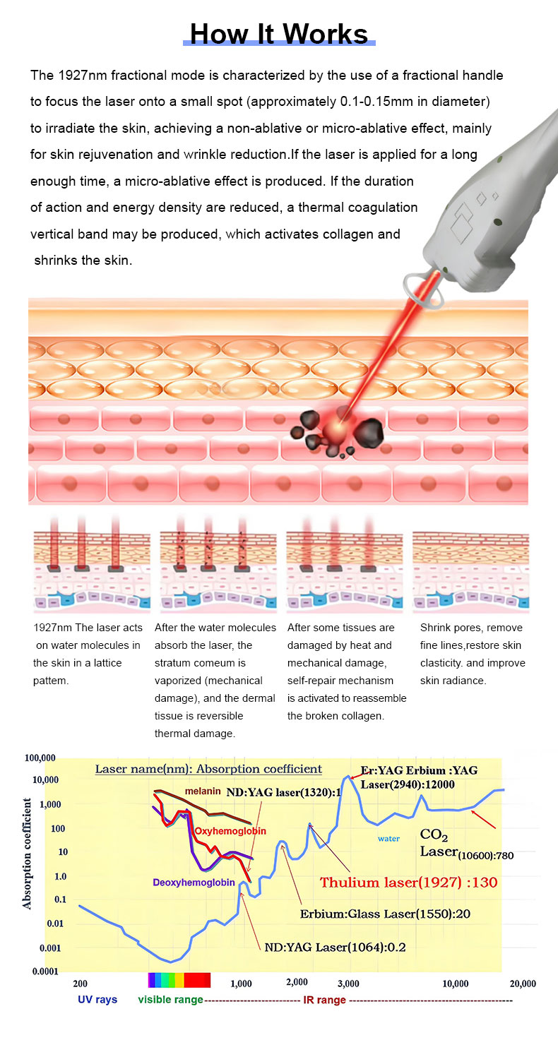 1927nm l&aacute;ser fraccional