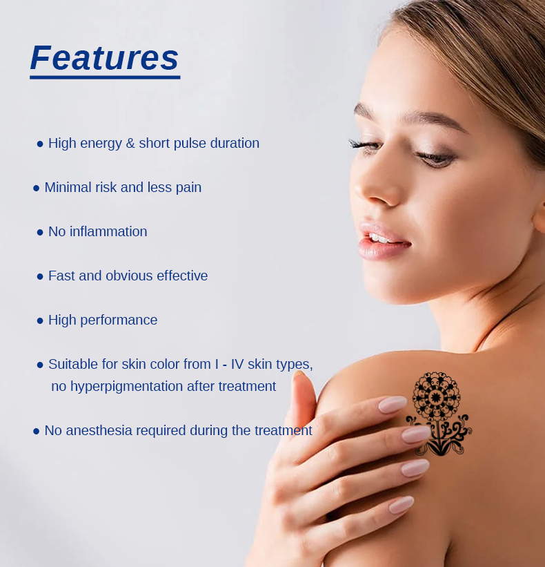 m&aacute;quina de extracci&oacute;n de tatuajes