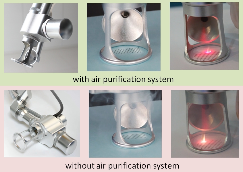 Sistema de purificación de aire para máquina de láser de CO2 fraccionado