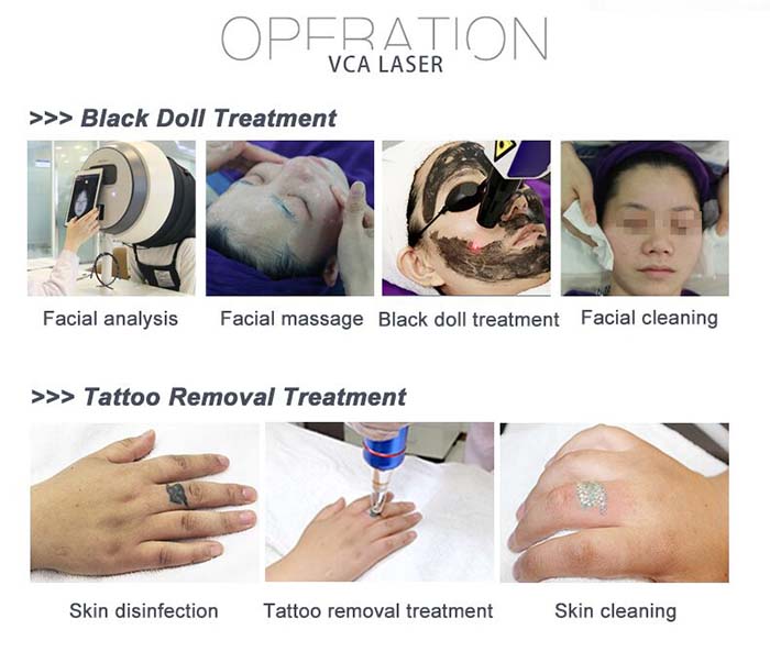 eliminaci&oacute;n de tatuajes pico