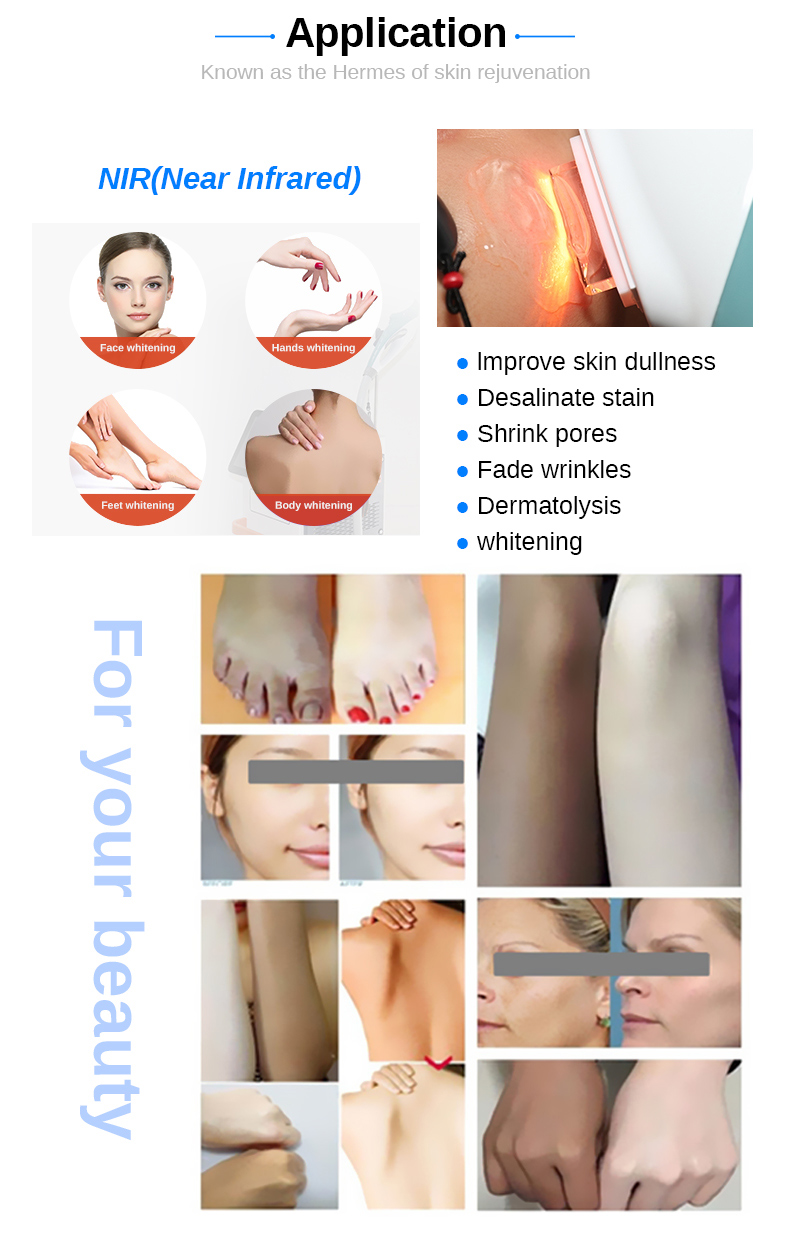 La mejor m&aacute;quina blanqueadora efectiva 