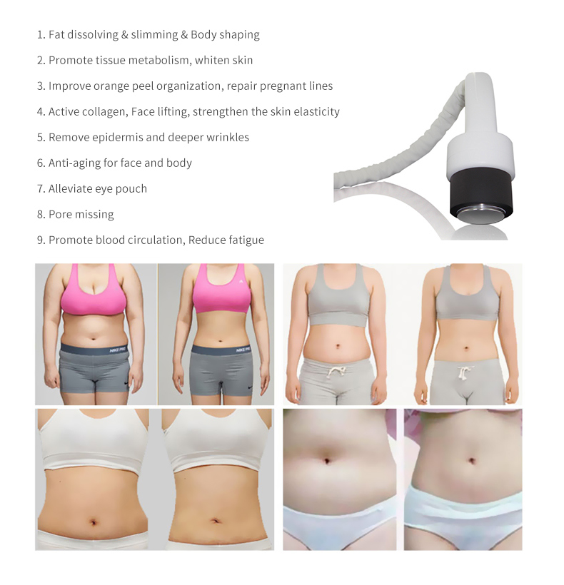 maquina para adelgazar