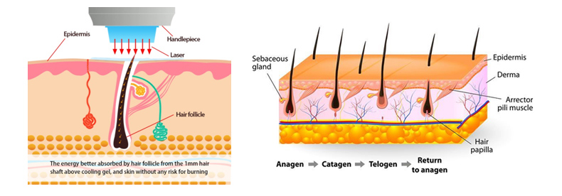 Depilaci&oacute;n l&aacute;ser 