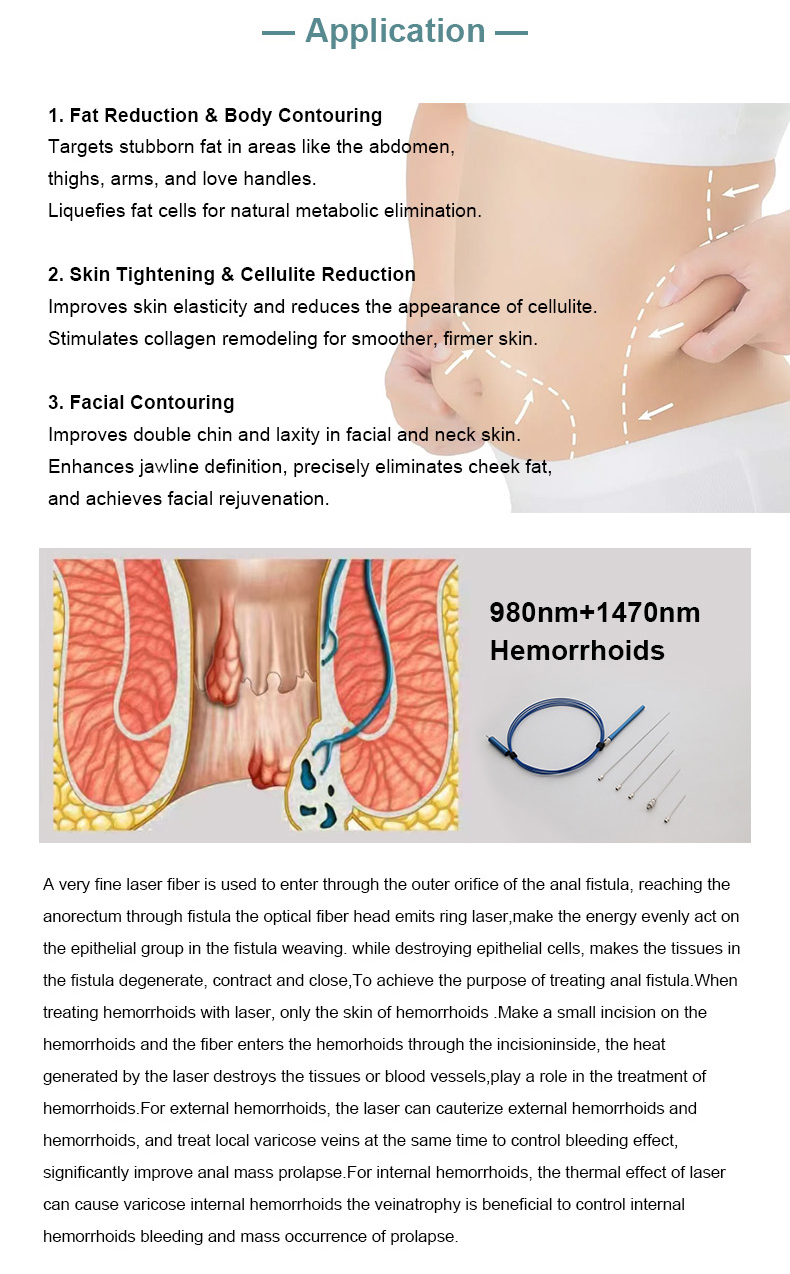 m&aacute;quina de lip&oacute;lisis l&aacute;ser de diodo