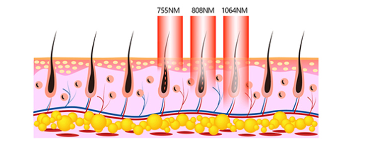 l&aacute;ser de diodo