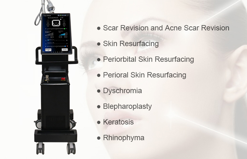 L&aacute;ser fraccional de CO2