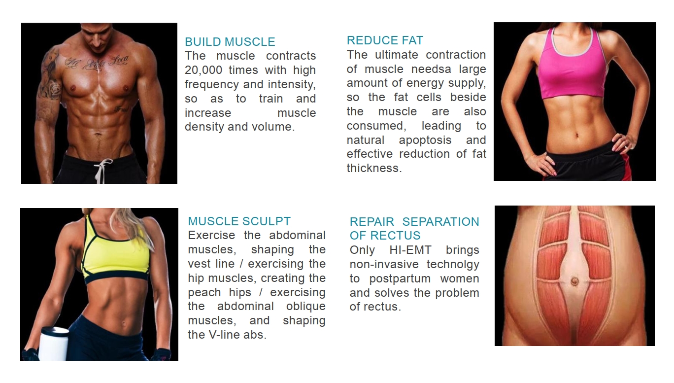 Aplicaciones EMSCULPT