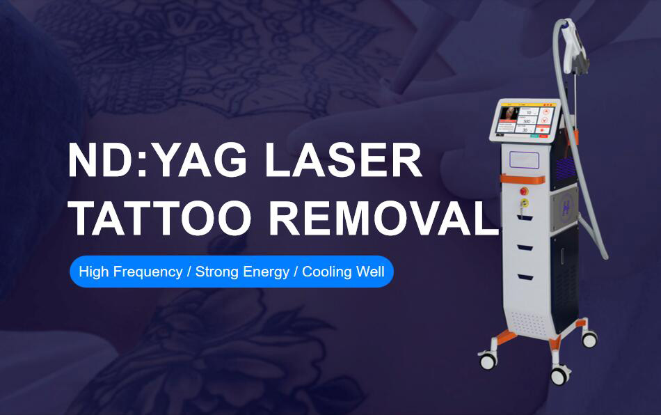Máquina láser para eliminación de tatuajes