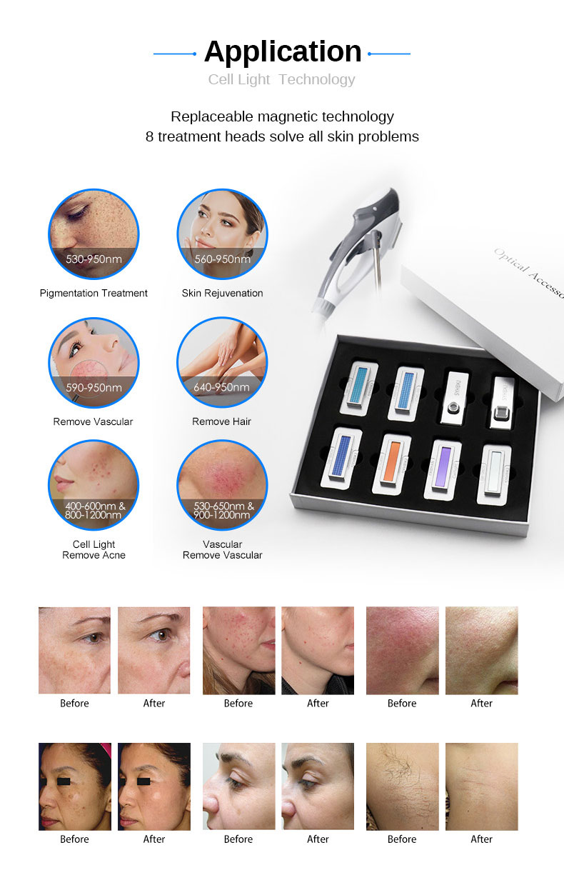 M&aacute;quina de eliminaci&oacute;n de arrugas