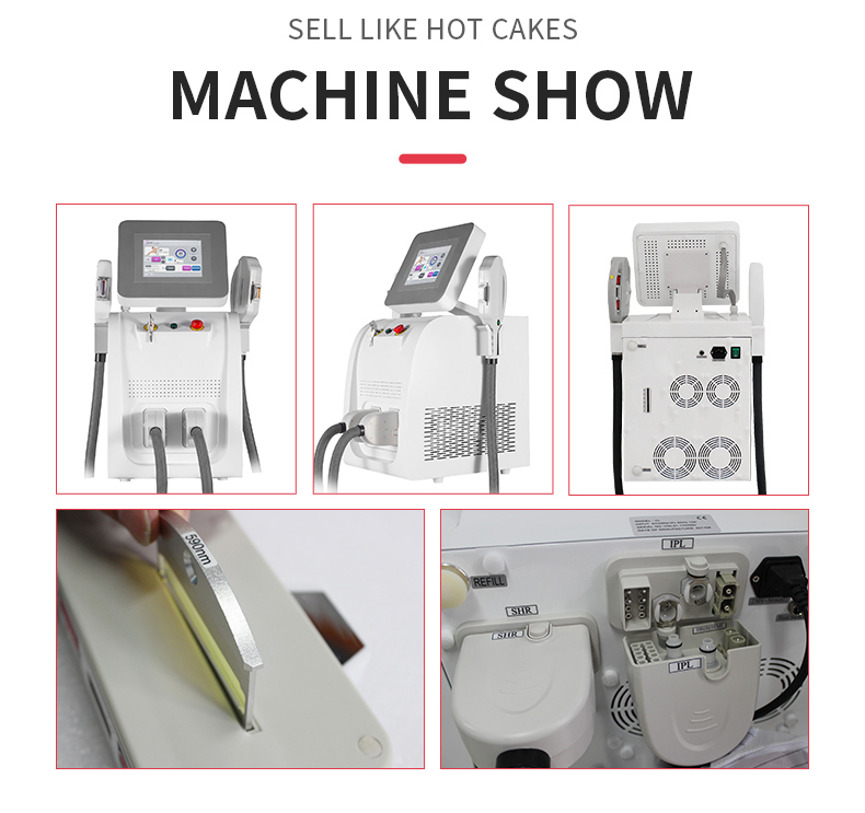 M&aacute;quina de depilaci&oacute;n OPT IPL