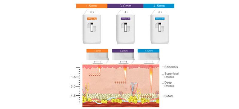 M&aacute;quina hifu profesional