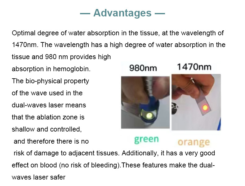 m&aacute;quina de lip&oacute;lisis l&aacute;ser de diodo