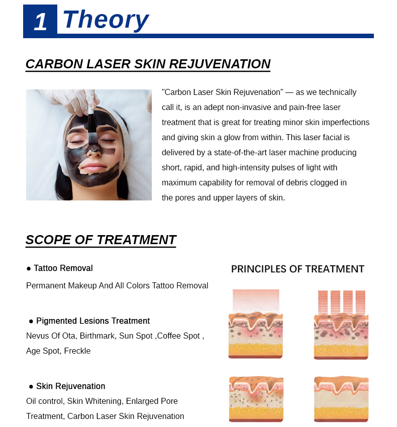 m&aacute;quina de extracci&oacute;n de tatuajes