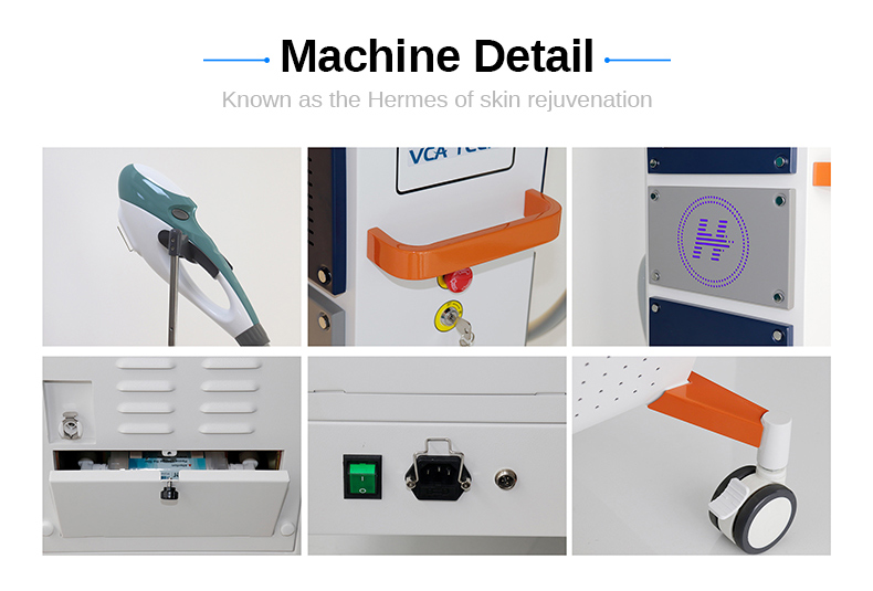 La mejor m&aacute;quina blanqueadora efectiva