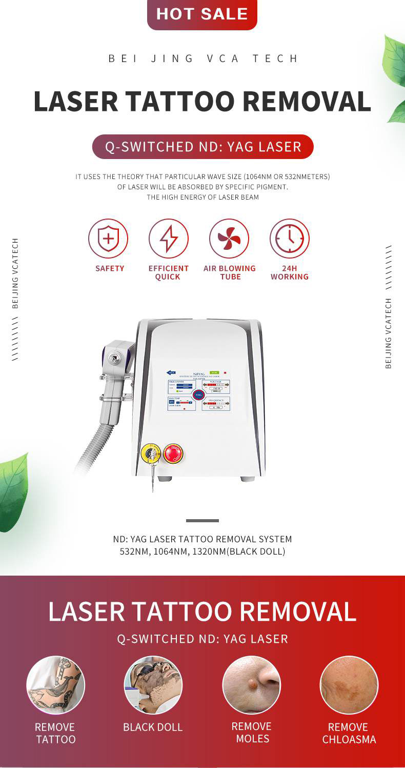 remoci&oacute;n del tatuaje l&aacute;ser