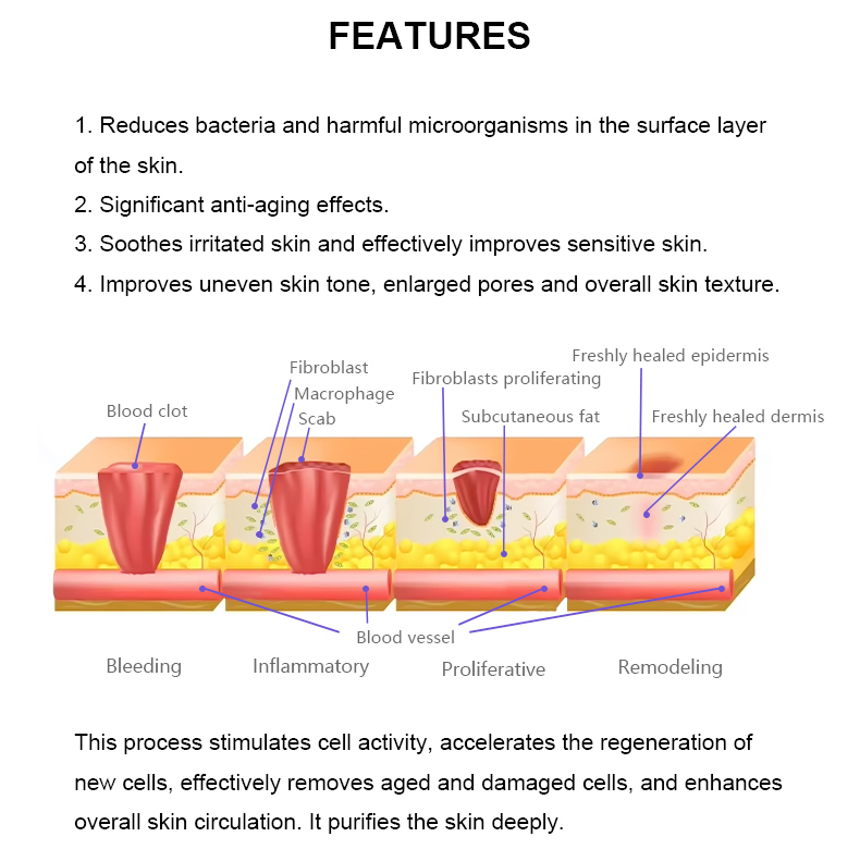M&aacute;quina de plasma fr&iacute;o
