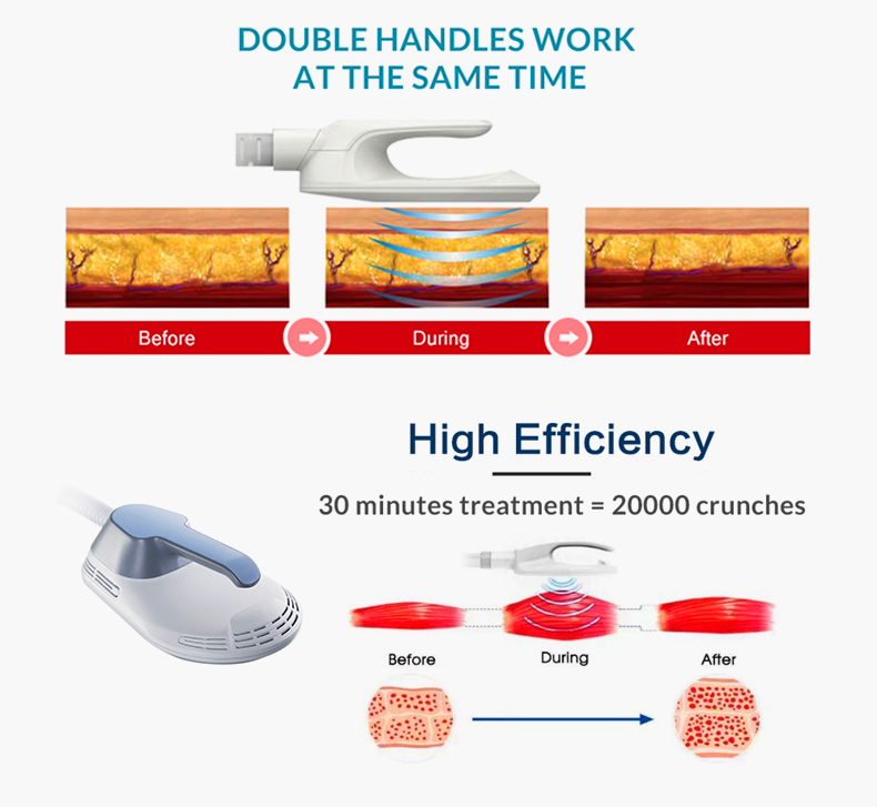 M&aacute;quina para esculpir el cuerpo EM