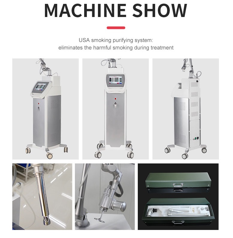 L&aacute;ser fraccional CO2