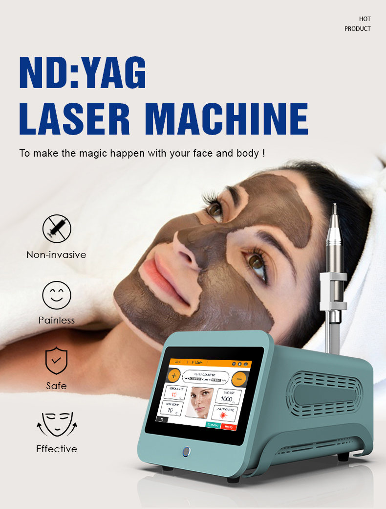 m&aacute;quina de extracci&oacute;n de tatuajes