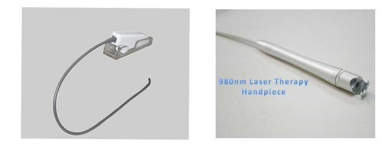 Eliminaci&oacute;n de la vena de ara&ntilde;a