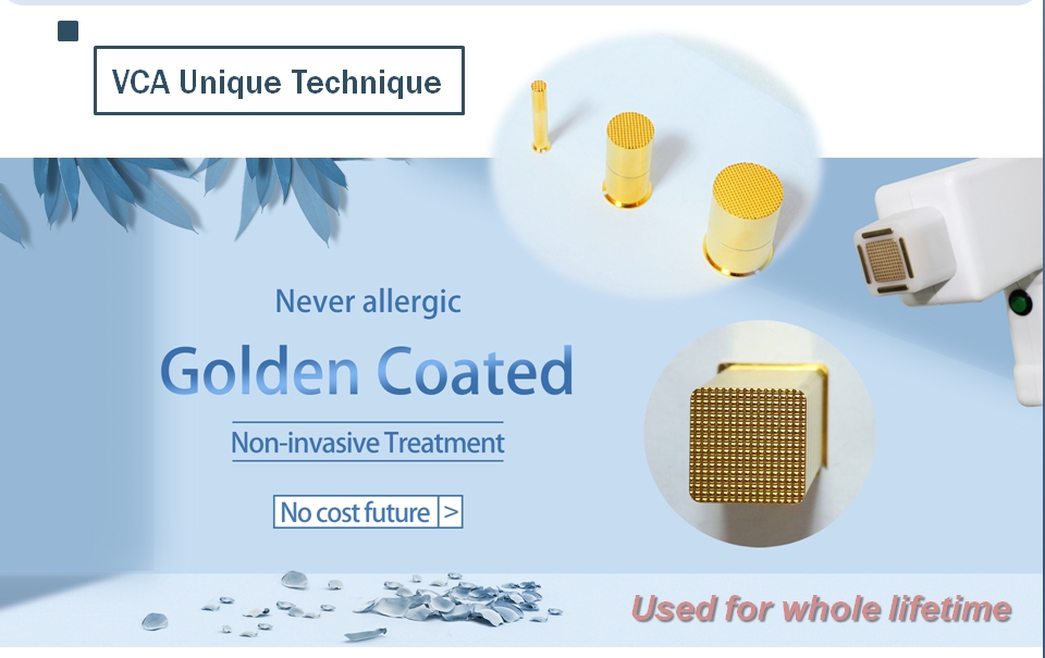 cabeza recubierta de oro