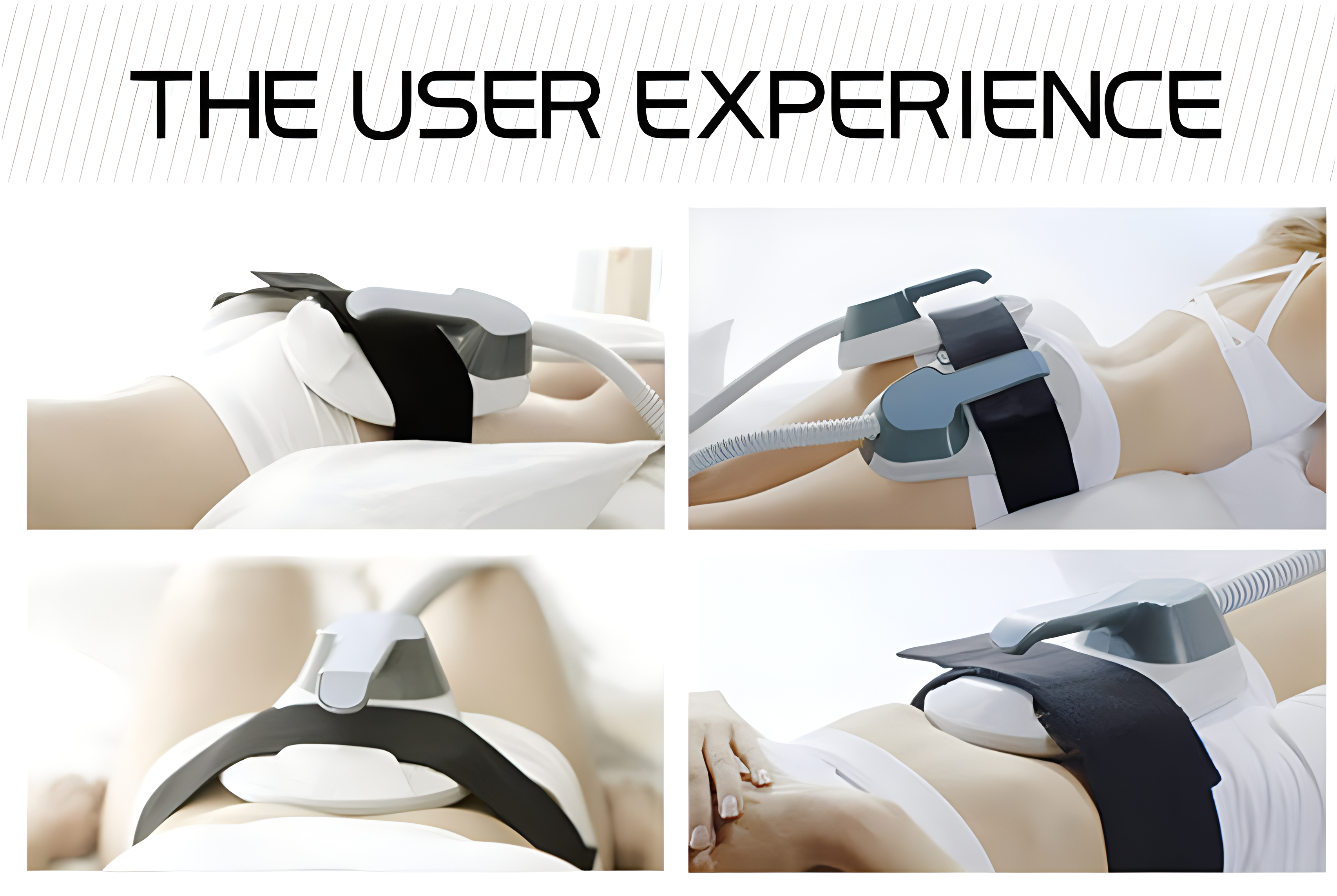 &Aacute;reas de tratamiento de EMS 