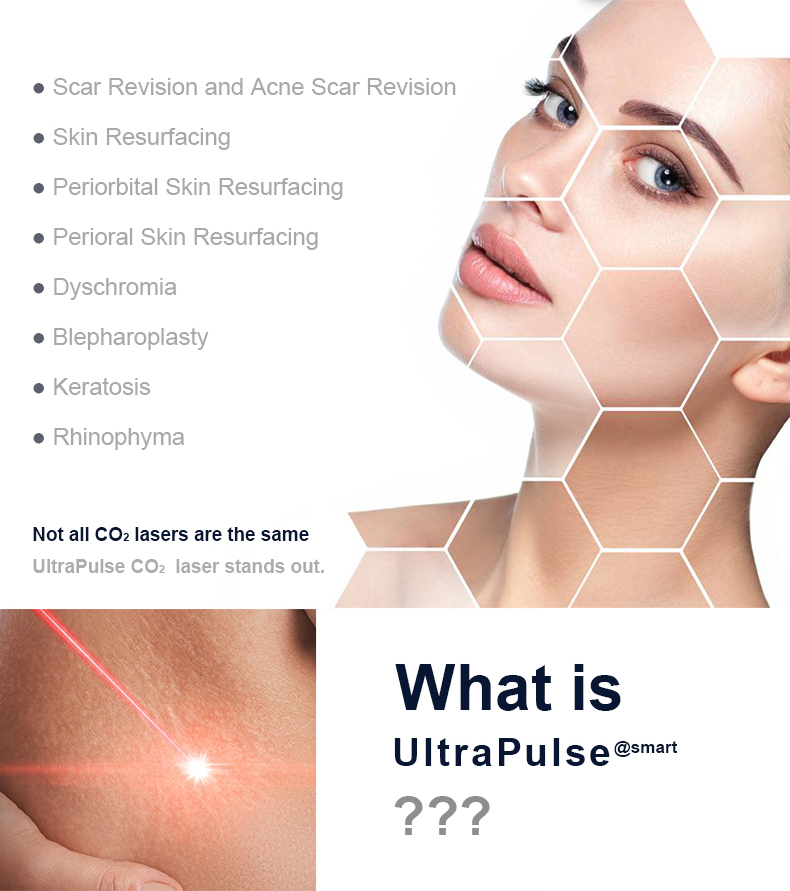 L&aacute;ser quir&uacute;rgico